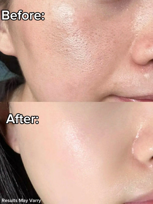 Anchira Overnight Peptide Recovery Mask